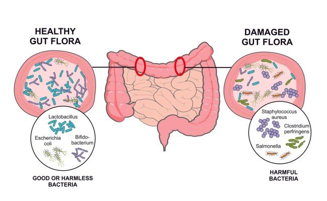 5 Things That Will Help Keep Your Microbiome Healthy ...