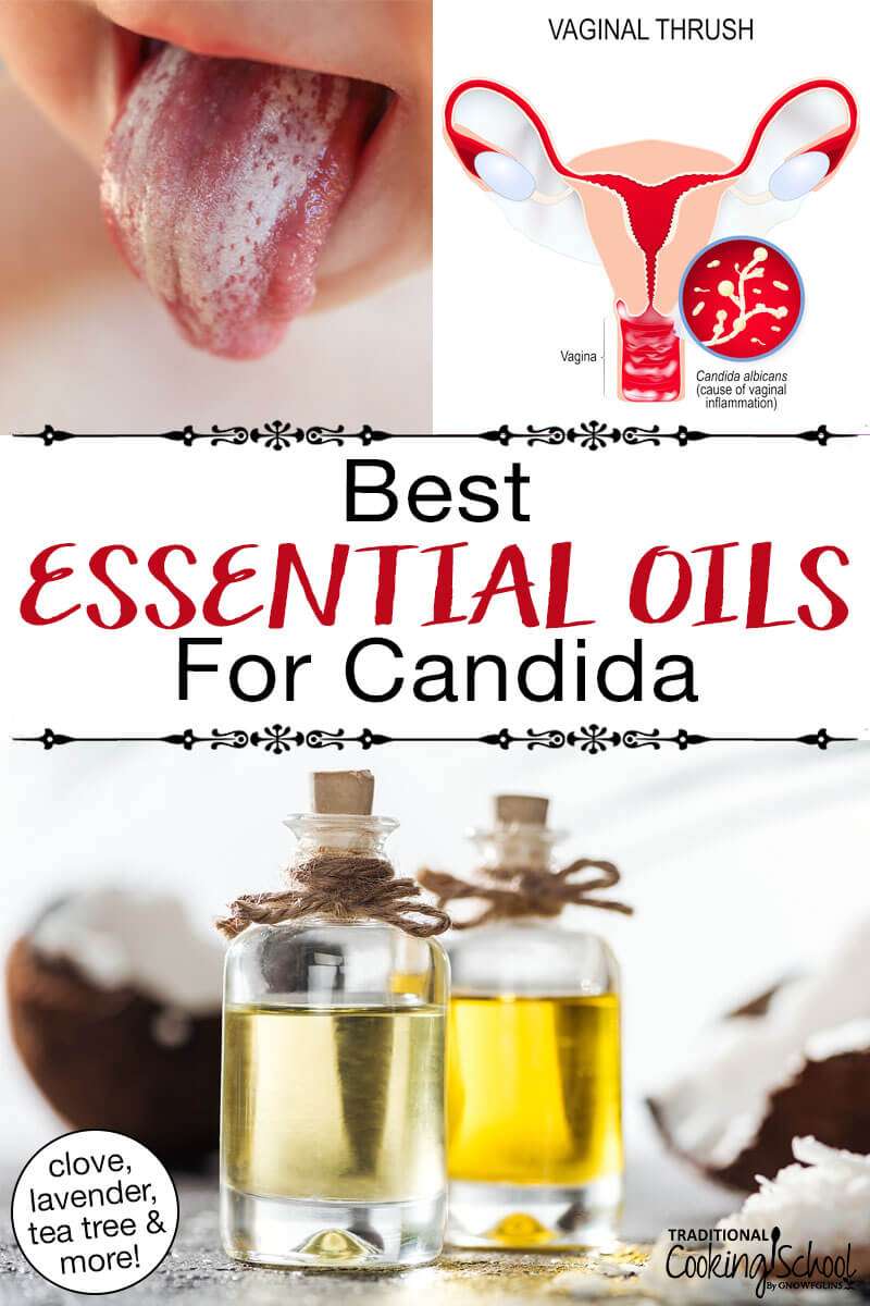 6 Essential Oils For Candida (+ Oral Thrush Mouthwash Recipe!)