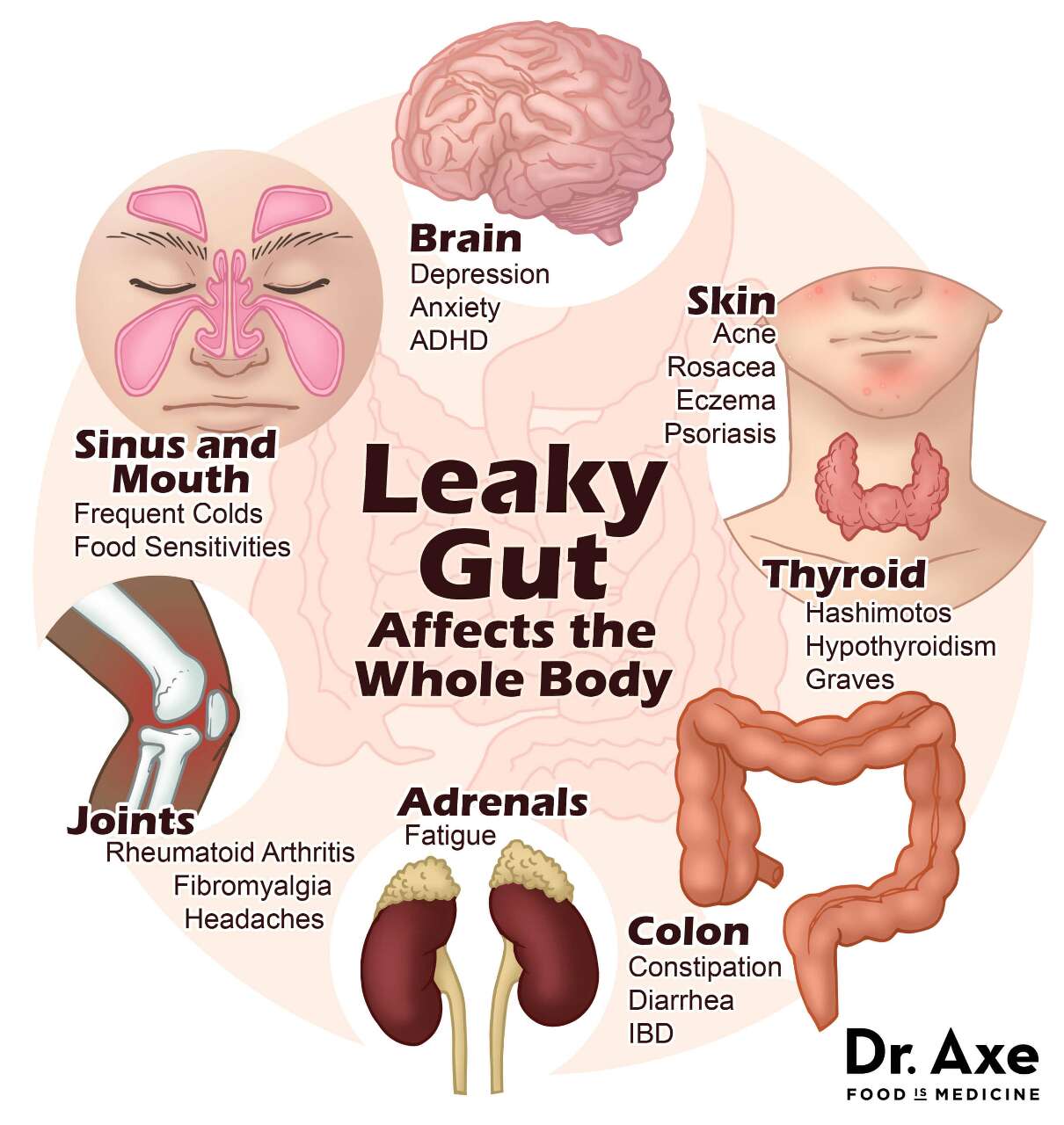 7 Signs and Symptoms You Have Leaky Gut Dr. Axe on ...