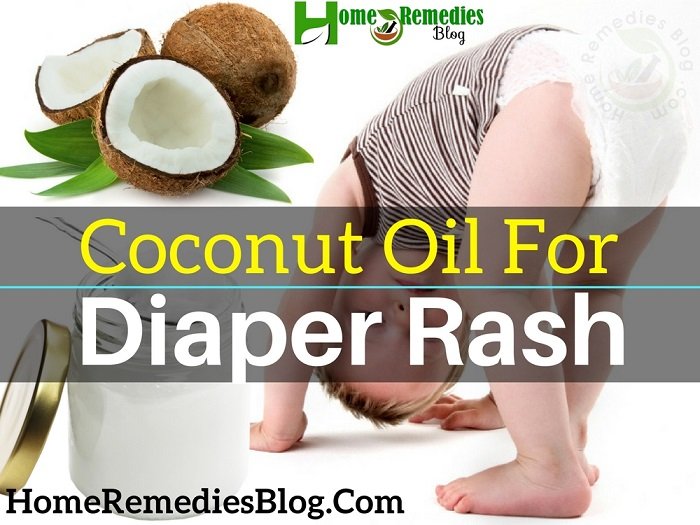 9 Best Ways to Use Coconut Oil for Diaper Rash in Babies ...