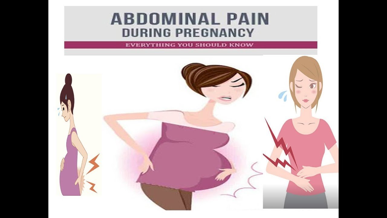 Abdominal pain during pregnancy causes sign