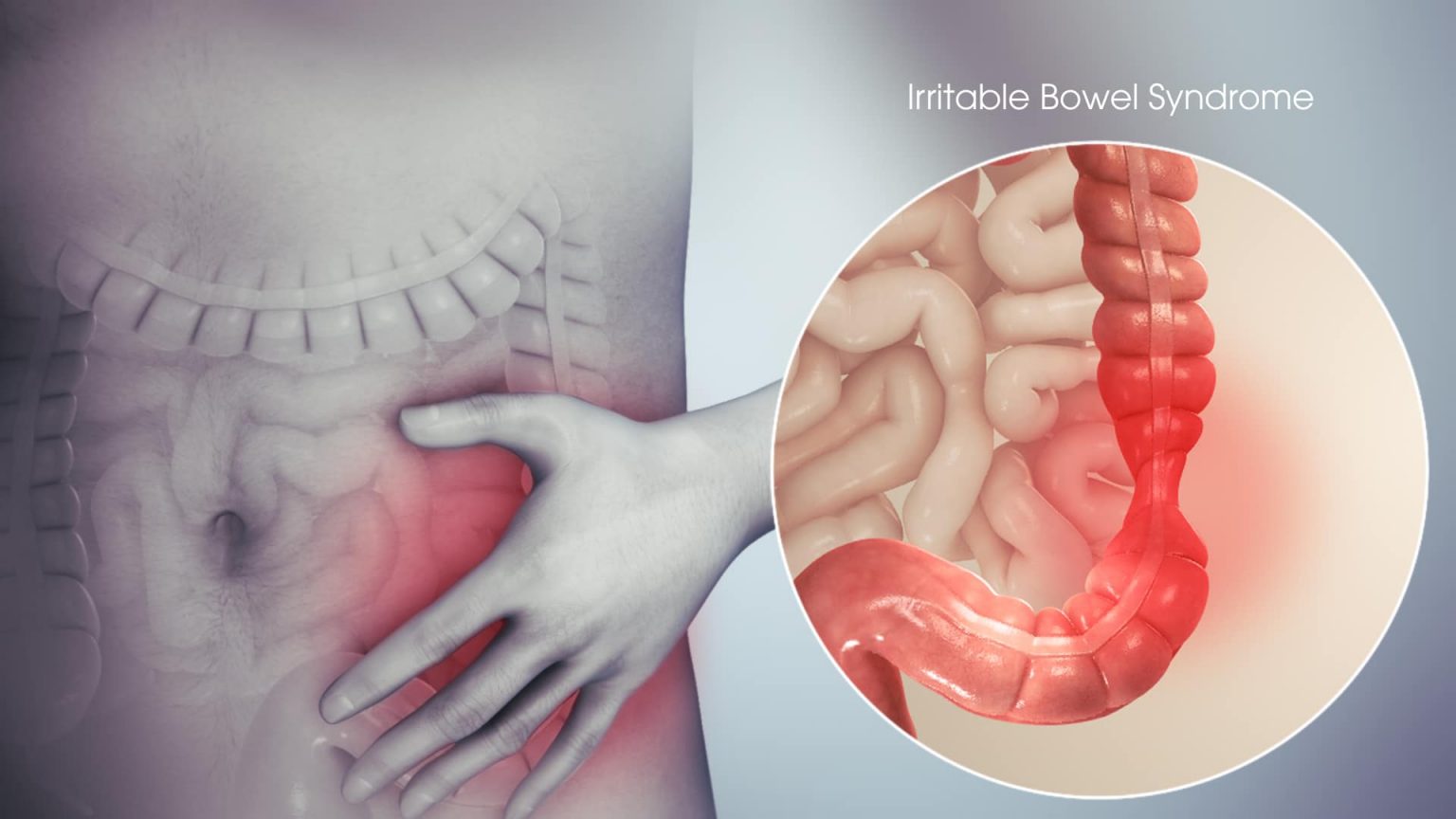 All About Irritable Bowel Syndrome And CBD For IBS ...