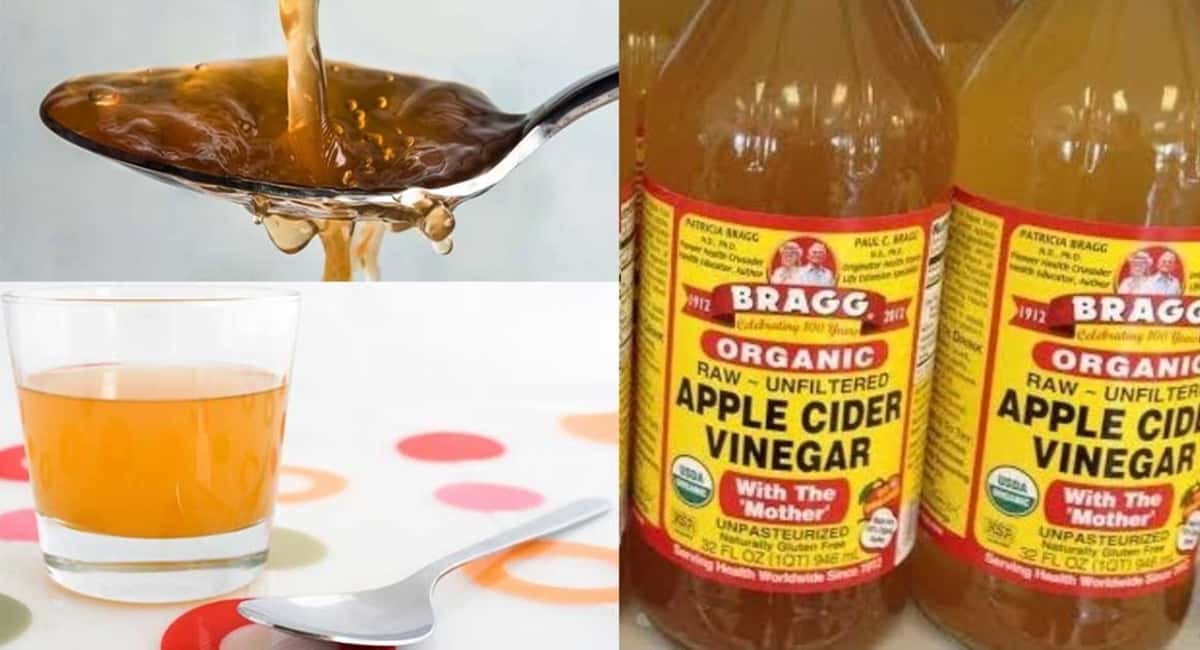 Apple Cider Vinegar With Mother Benefits