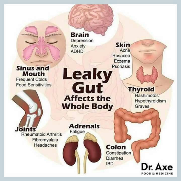 Are you being affected by leaky gut? Plexus can help ...