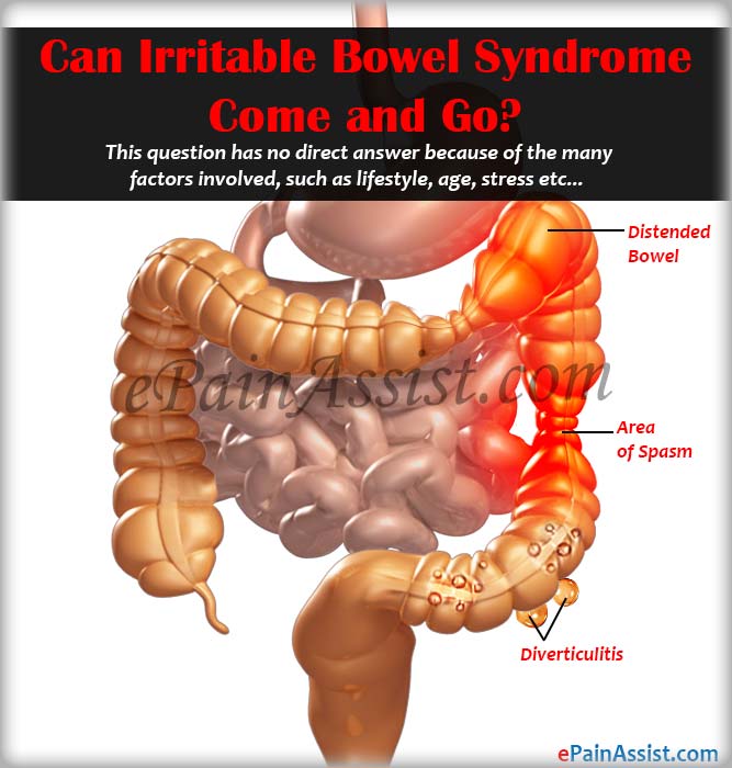 Can Irritable Bowel Syndrome Come and Go?