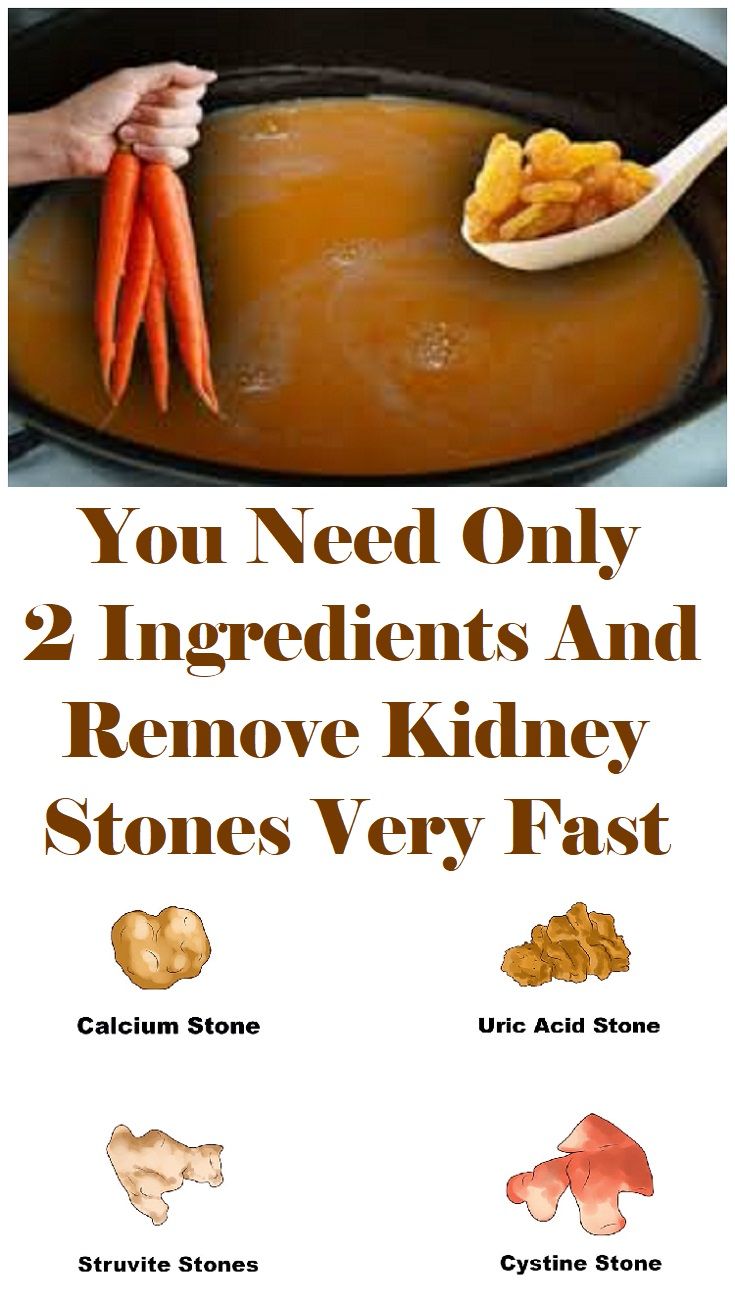 Can Kidney Stones Cause Vomiting And Diarrhea