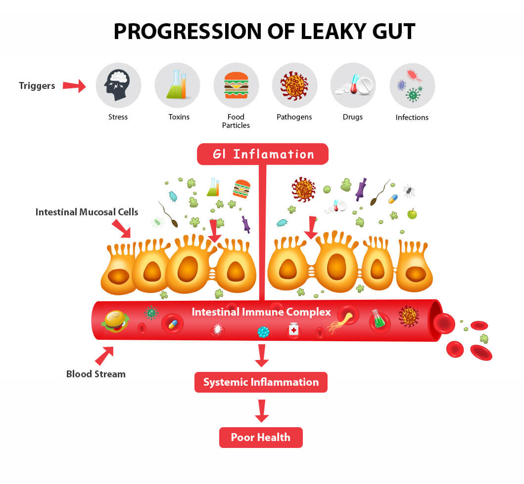 Can Leaky Gut Syndrome Cause Autoimmune Problems ...
