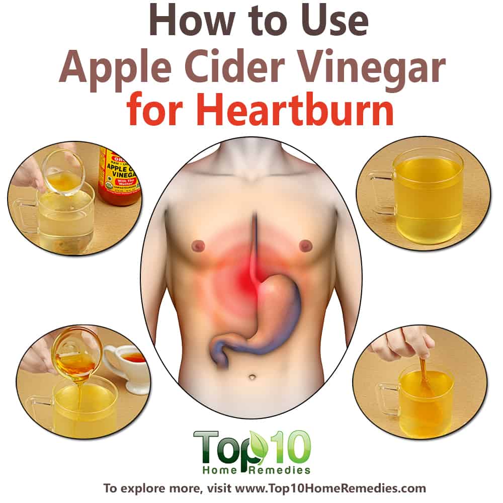 Can Use Apple Cider Vinegar for Heartburn?