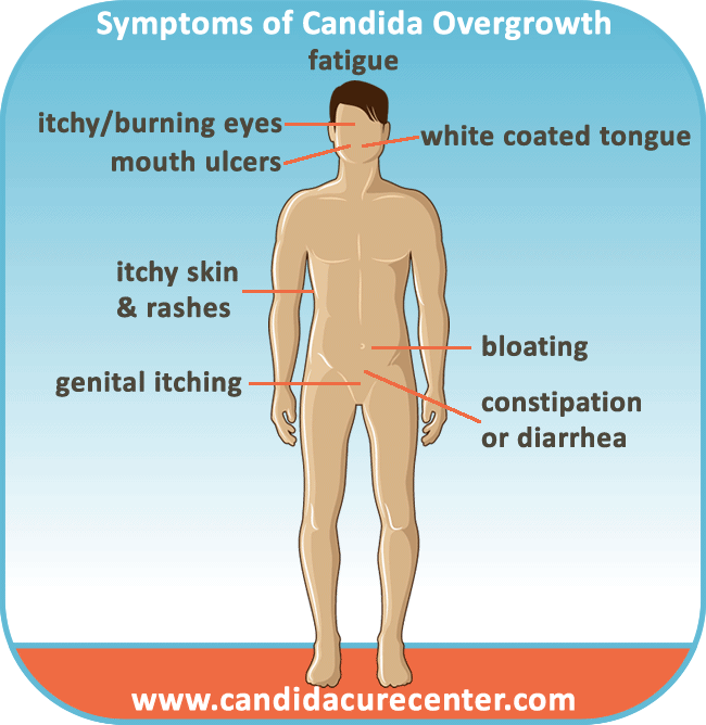 Candida Albicans Overgrowth Symptoms