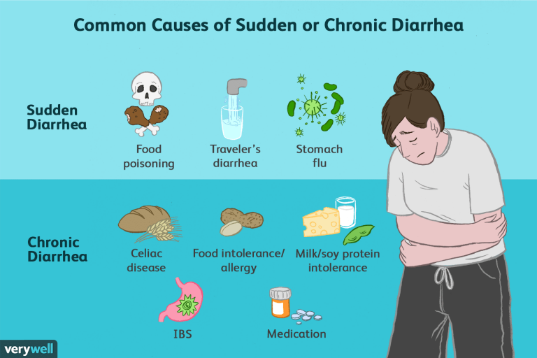 Causes of Chronic Diarrhea