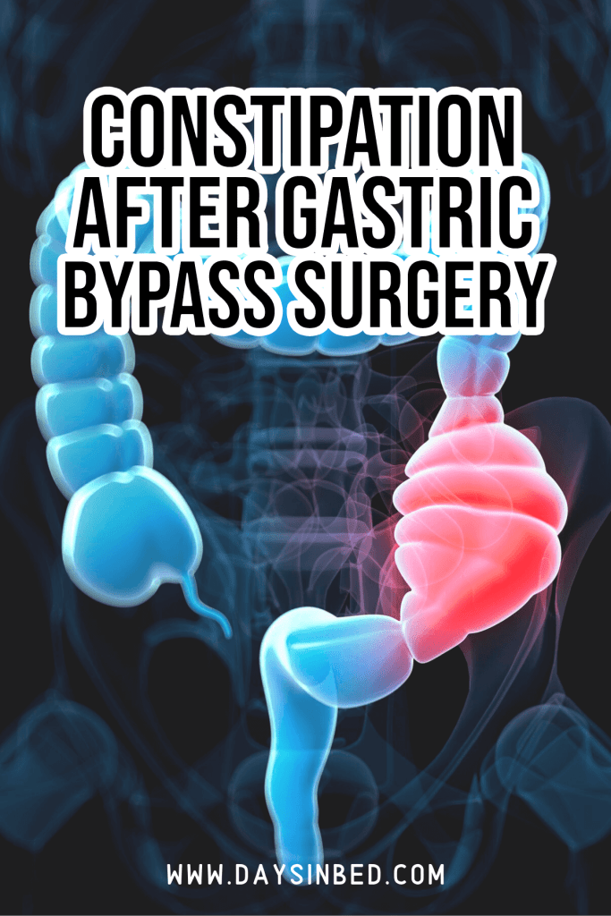 Constipation After Gastric Bypass Surgery