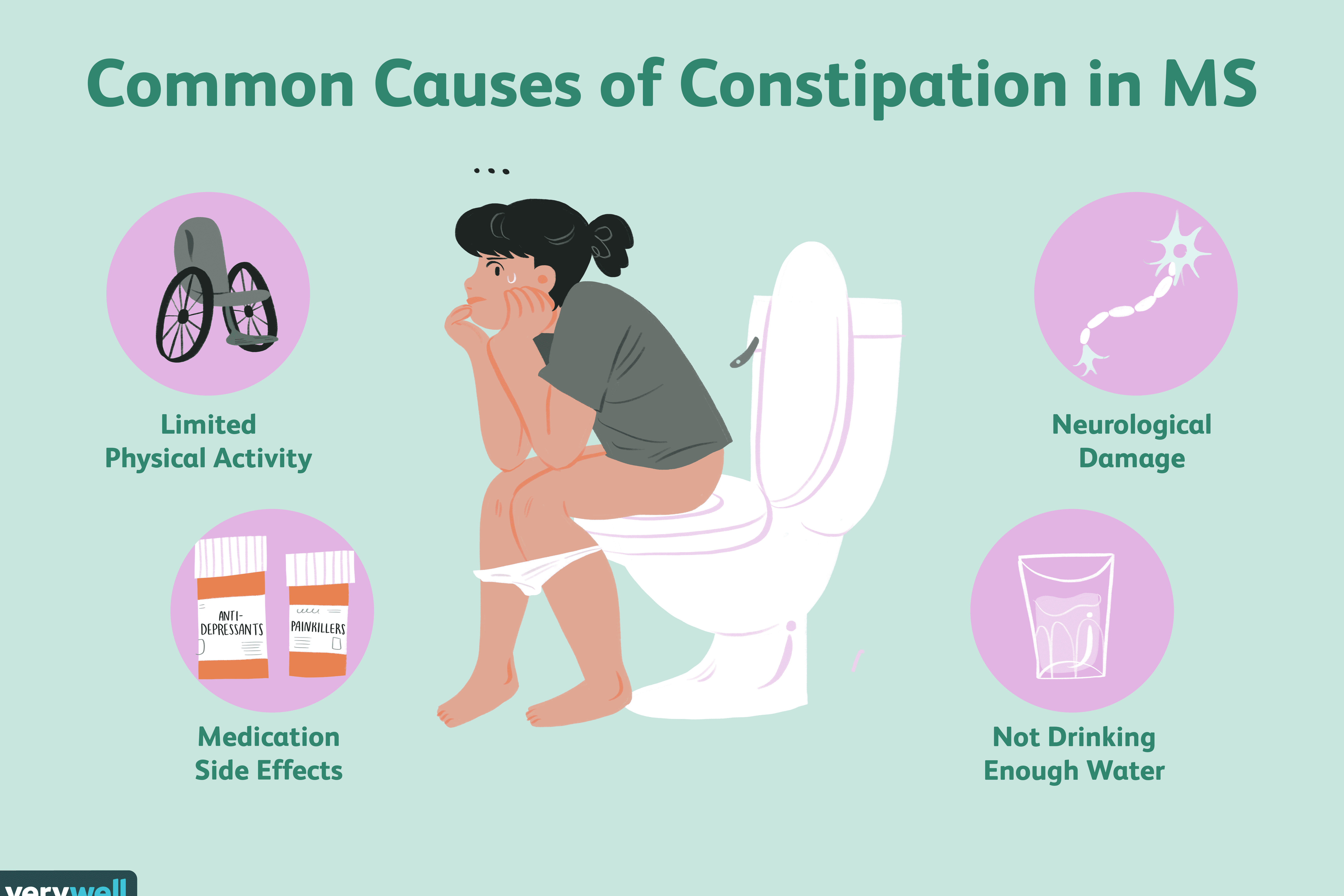 Constipation in MS: Causes, Diagnosis, and Treatment
