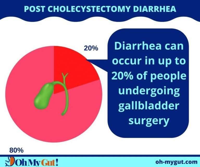 Diarrhea After Gallbladder Removal: Causes, How Long It Lasts ...