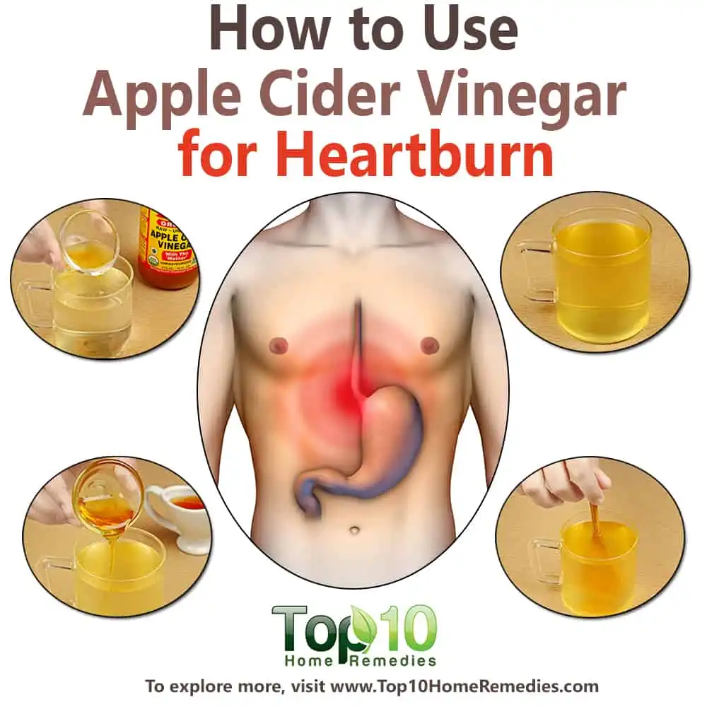 Does Apple Cider Vinegar Help Heartburn