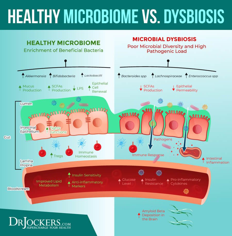 Dysbiosis: What is It and How to Heal Your Microbiome ...