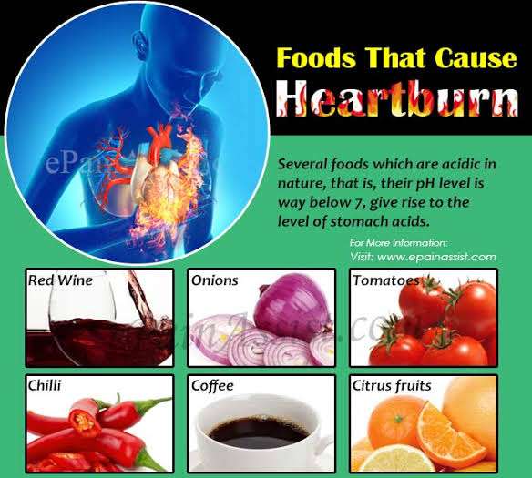 Foods And Drinks To Avoid To Invalidate Heartburn