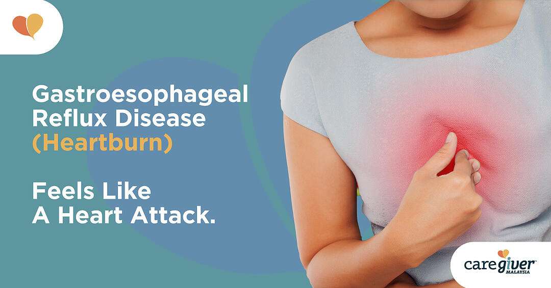 Gastroesophageal Reflux Disease (Heartburn): Feels Like A Heart Attack