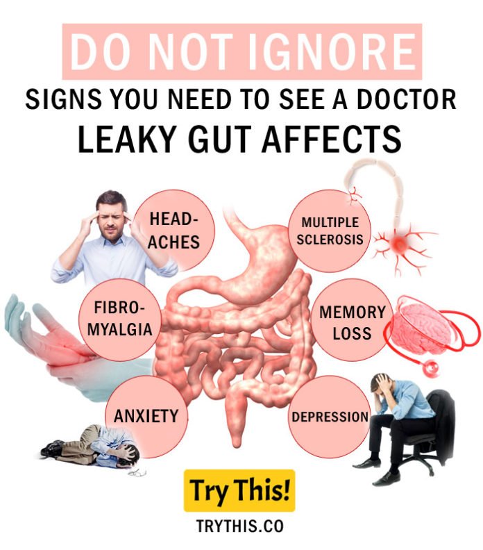How to Cure Leaky Gut Syndrome with Diet