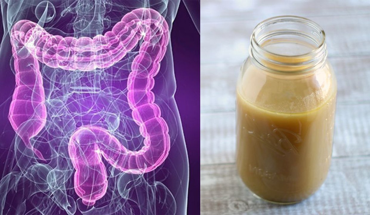 How To Deal With A Leaky Gut: Everything You Need To Know ...