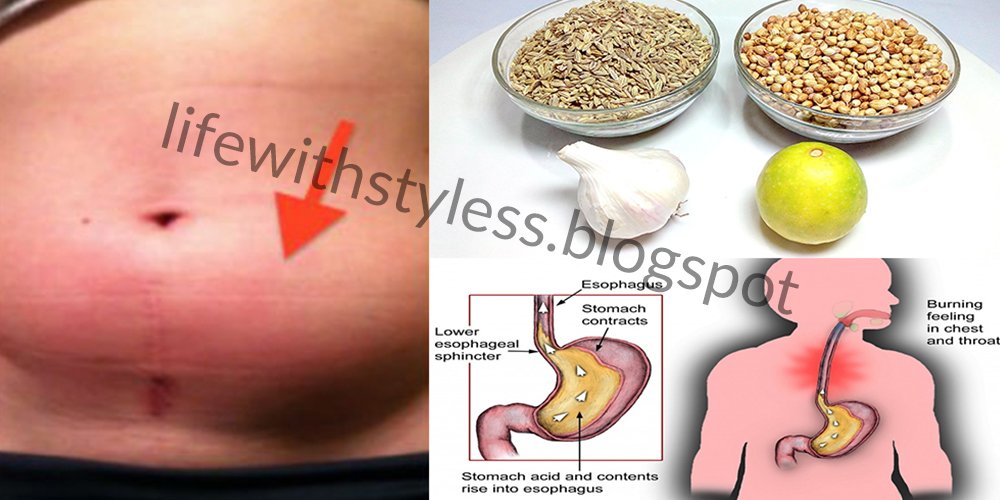 How to Get Rid Of Gas and Bloating in 60 Minutes Naturally ...