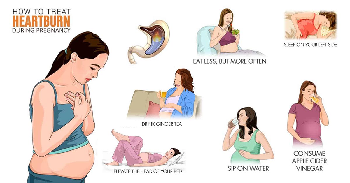 How to get rid of heartburn when pregnant naturally ...