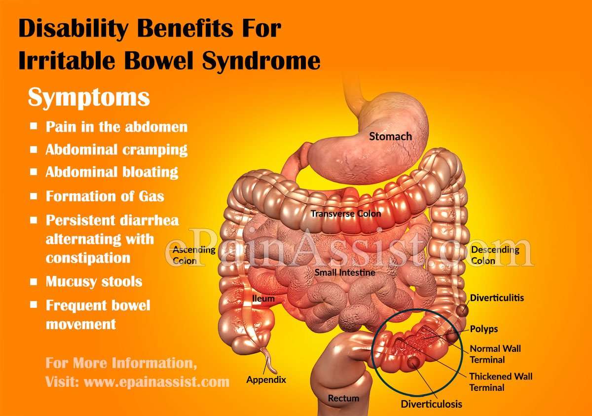 Irritable bowel syndrome Causes, Symptoms and Treatment ...