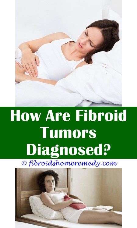 Large Fibroid Tumors Complications