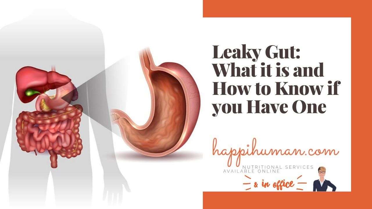 Leaky Gut: What it is and How to Know if you Have One ...