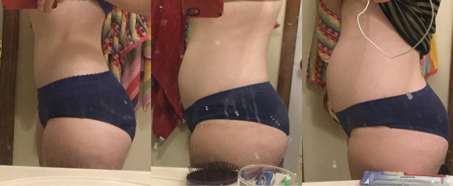 my endo belly a little while ago, 4 days pre period, 1 day ...
