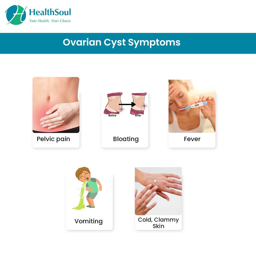 Ovarian Cysts: Symptoms, Diagnosis and Treatment