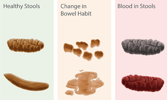 Poo chart reveals what
