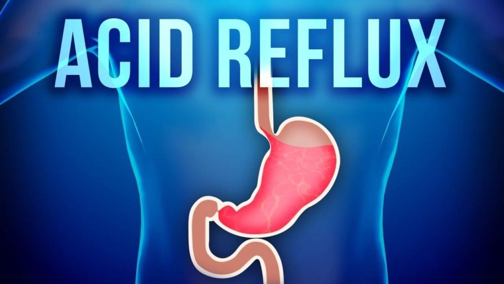 Some of the Causes of Acid Reflux, Heartburn &  GERD  3 ...
