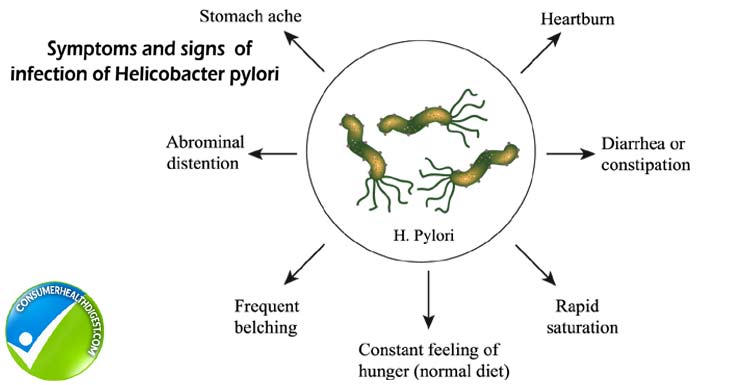 Suffering From H. Pylori? Count Down To Cope Up With It!