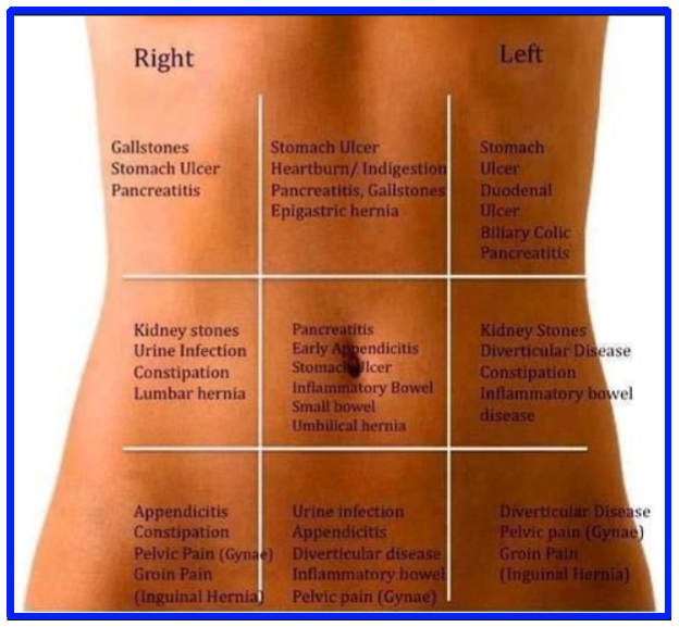 Typical &  Atypical IBS Pain Locations: A Complete In