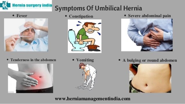 Umbilical Hernia Repair Surgery In Chennai