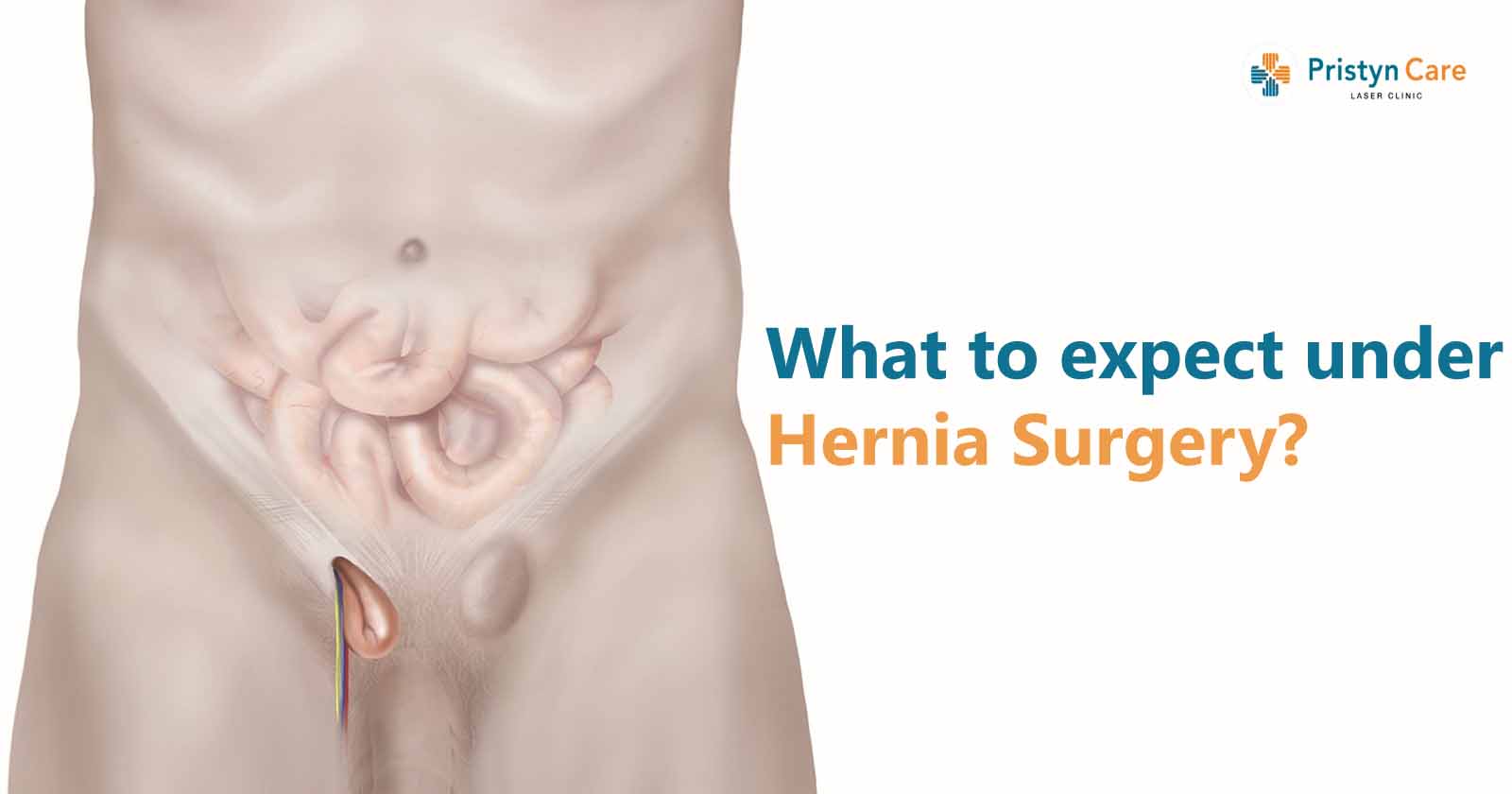 What to expect under Hernia Surgery?